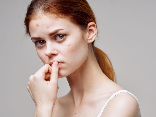Skin Picking Schäden